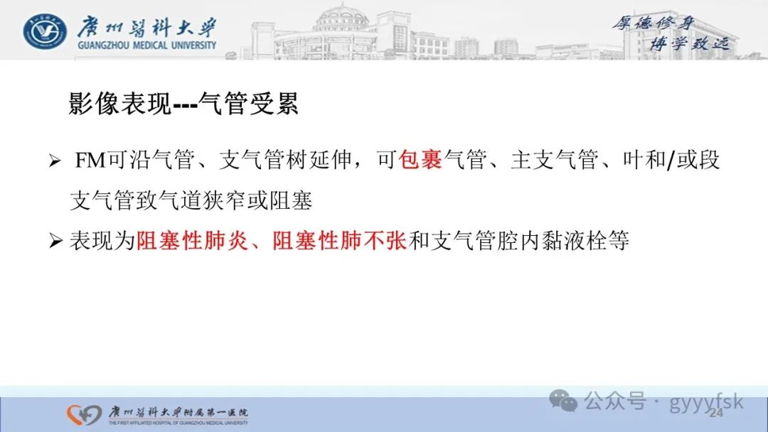 影像PPT - 【PPT】纤维素性纵隔炎-24