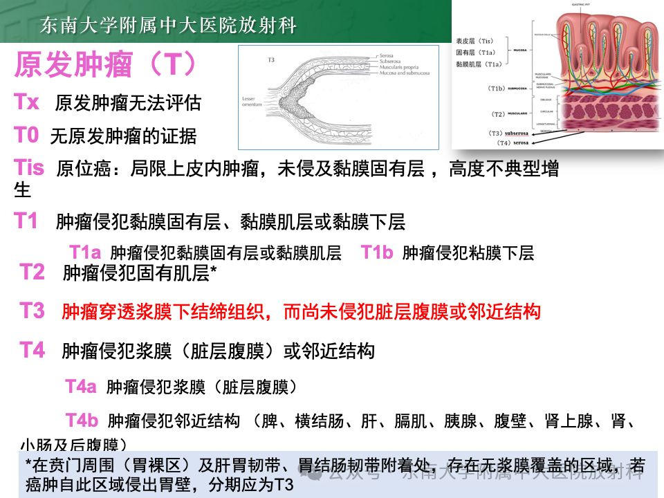 影像PPT - 【病例】胃部/胃周占位随访-8