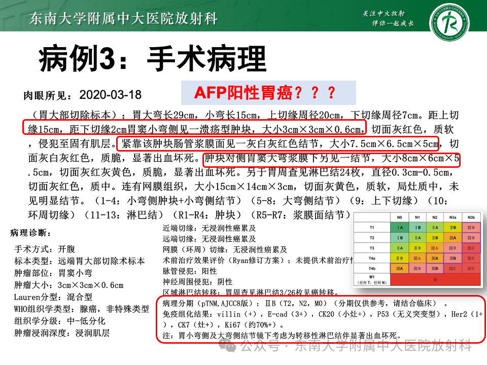 影像PPT - 【病例】胃部/胃周占位随访-21