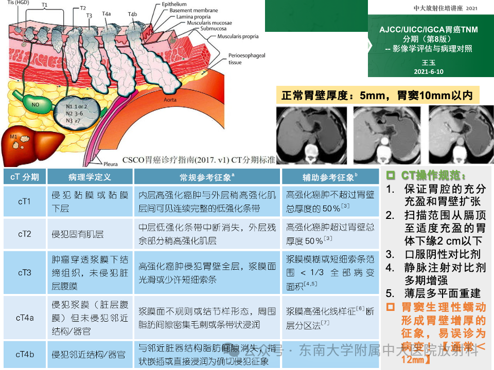 影像PPT - 【病例】胃部/胃周占位随访-37