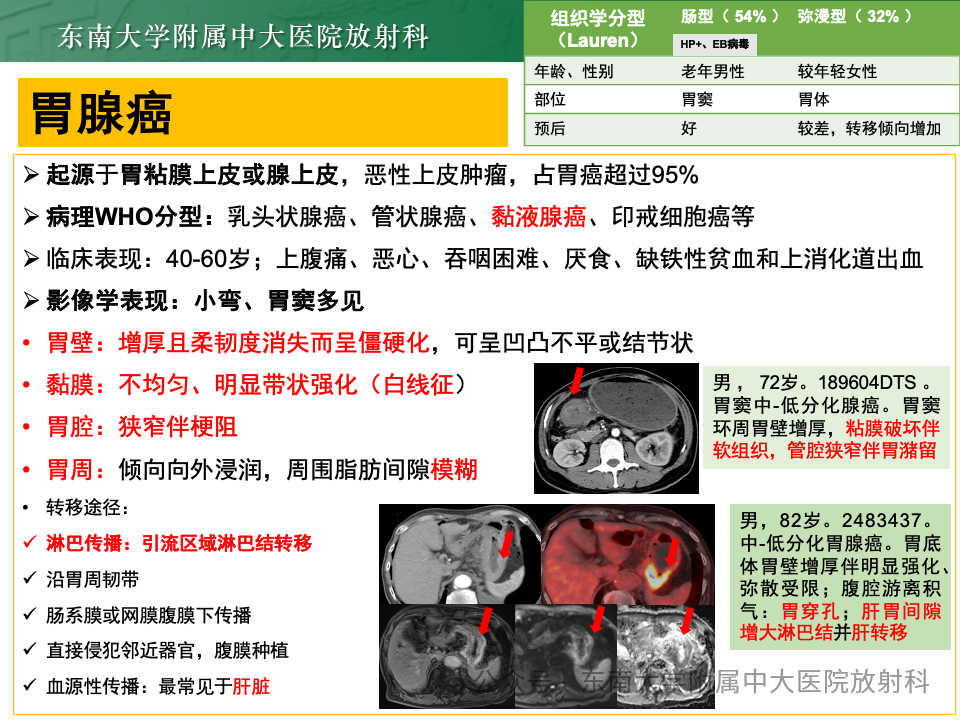 影像PPT - 【病例】胃部/胃周占位随访-39