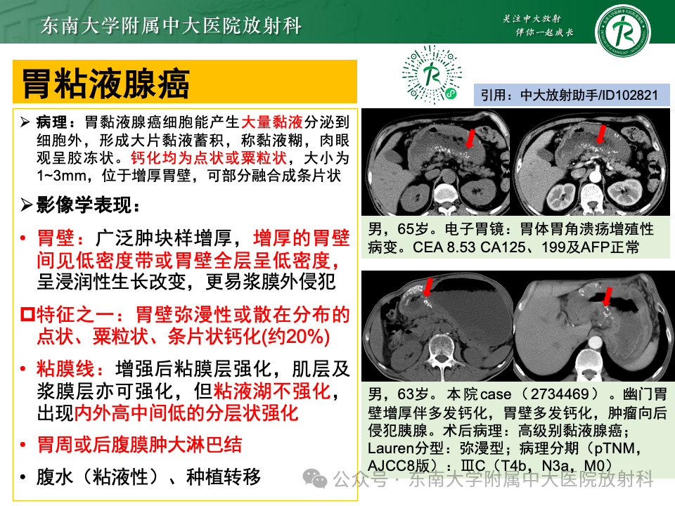 影像PPT - 【病例】胃部/胃周占位随访-40
