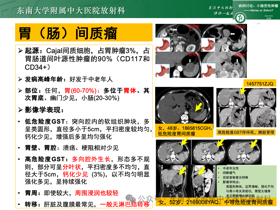 影像PPT - 【病例】胃部/胃周占位随访-49