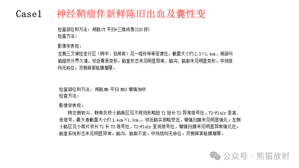 影像PPT - 【病例】鞍旁神经鞘瘤2例CT及MR影像-11