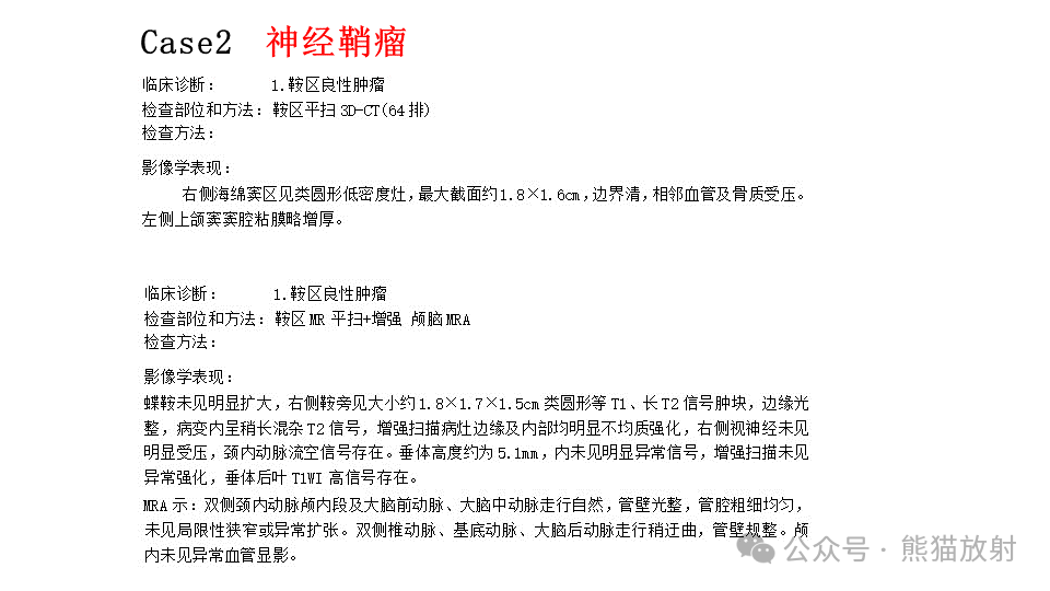 影像PPT - 【病例】鞍旁神经鞘瘤2例CT及MR影像-12