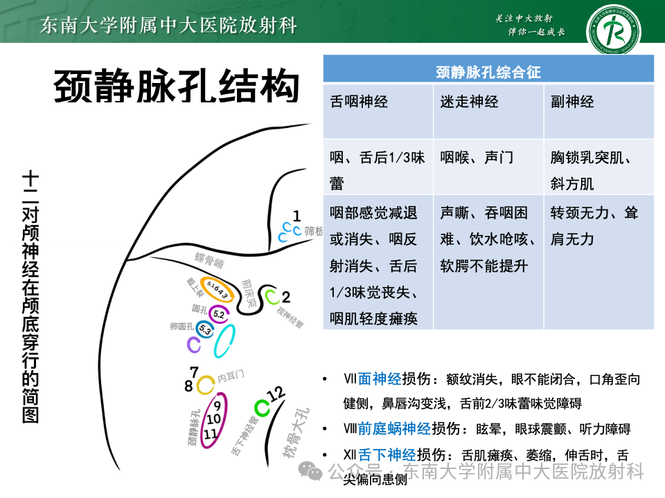 影像PPT - 【PPT】颈静脉孔区肿瘤-11 影像PPT - 【PPT】颈静脉孔区肿瘤-11