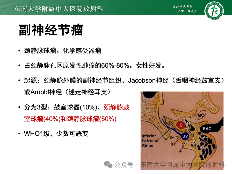 影像PPT - 【PPT】颈静脉孔区肿瘤-13 影像PPT - 【PPT】颈静脉孔区肿瘤-13