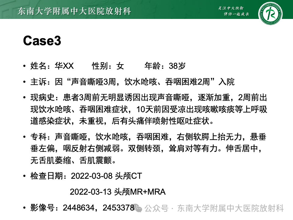影像PPT - 【PPT】颈静脉孔区肿瘤-21 影像PPT - 【PPT】颈静脉孔区肿瘤-21