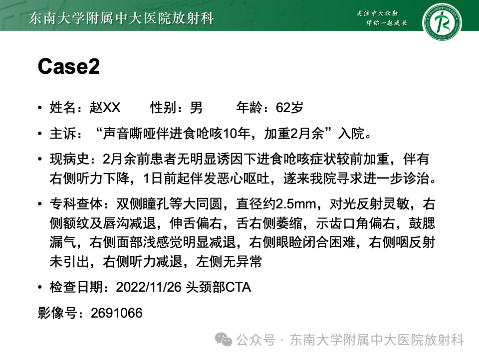 影像PPT - 【PPT】颈静脉孔区肿瘤-16 影像PPT - 【PPT】颈静脉孔区肿瘤-16