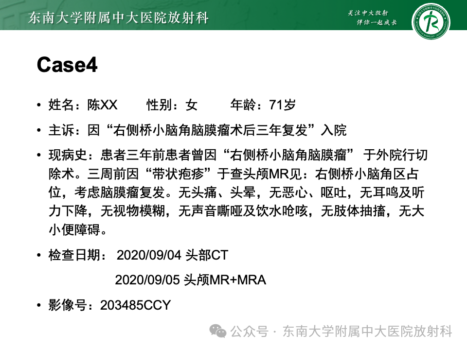 影像PPT - 【PPT】颈静脉孔区肿瘤-28 影像PPT - 【PPT】颈静脉孔区肿瘤-28