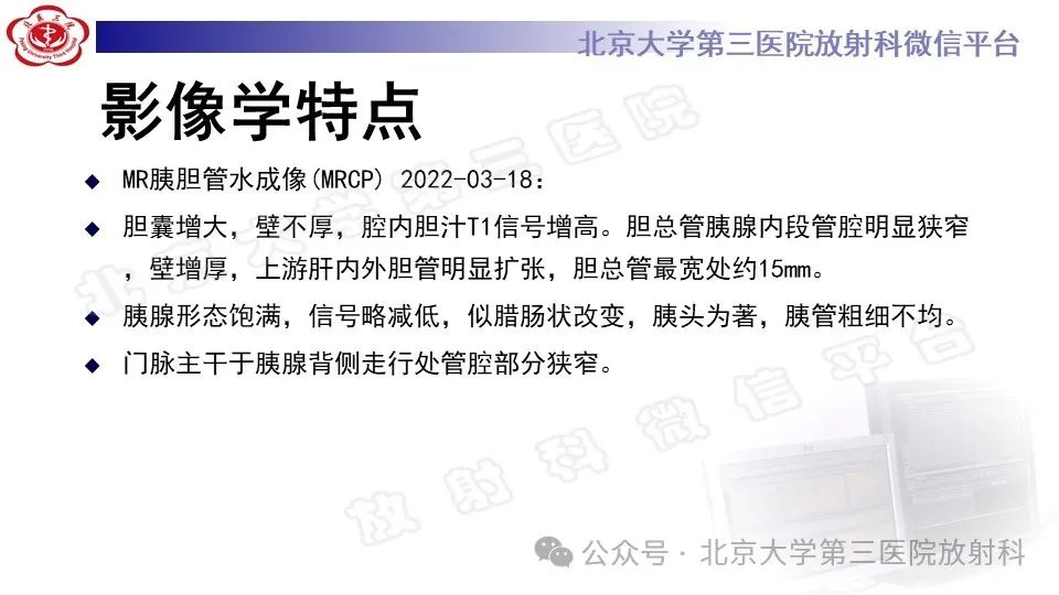 影像PPT - 【PPT】自身免疫性胰腺炎-8