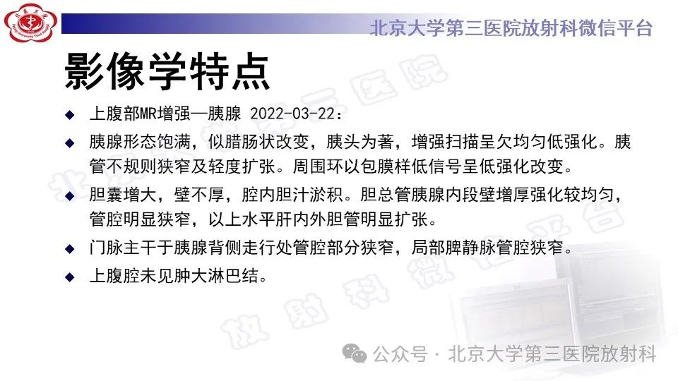 影像PPT - 【PPT】自身免疫性胰腺炎-7
