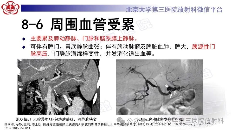 影像PPT - 【PPT】自身免疫性胰腺炎-28