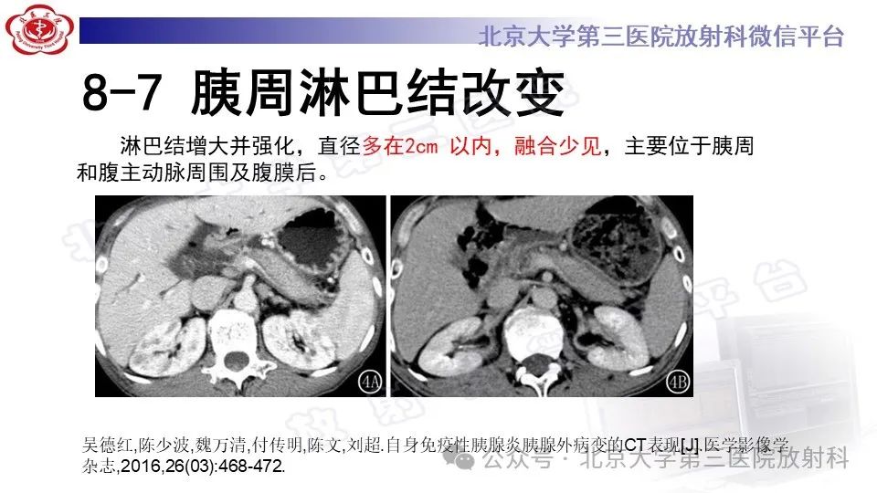 影像PPT - 【PPT】自身免疫性胰腺炎-30