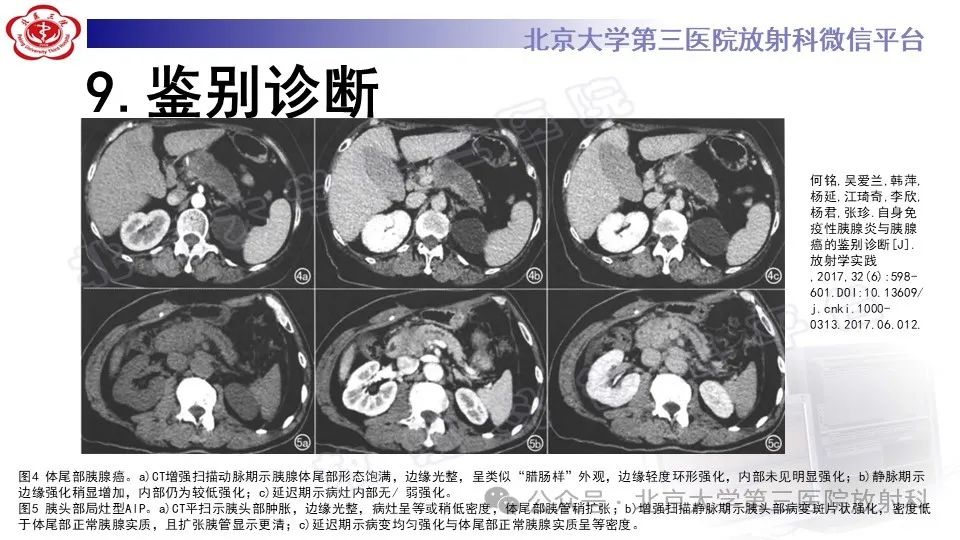 影像PPT - 【PPT】自身免疫性胰腺炎-34