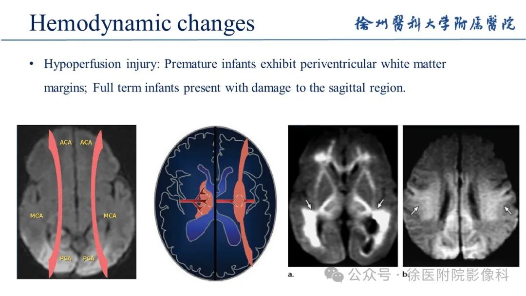 影像PPT - 【PPT】新生儿缺氧缺血性脑病-10