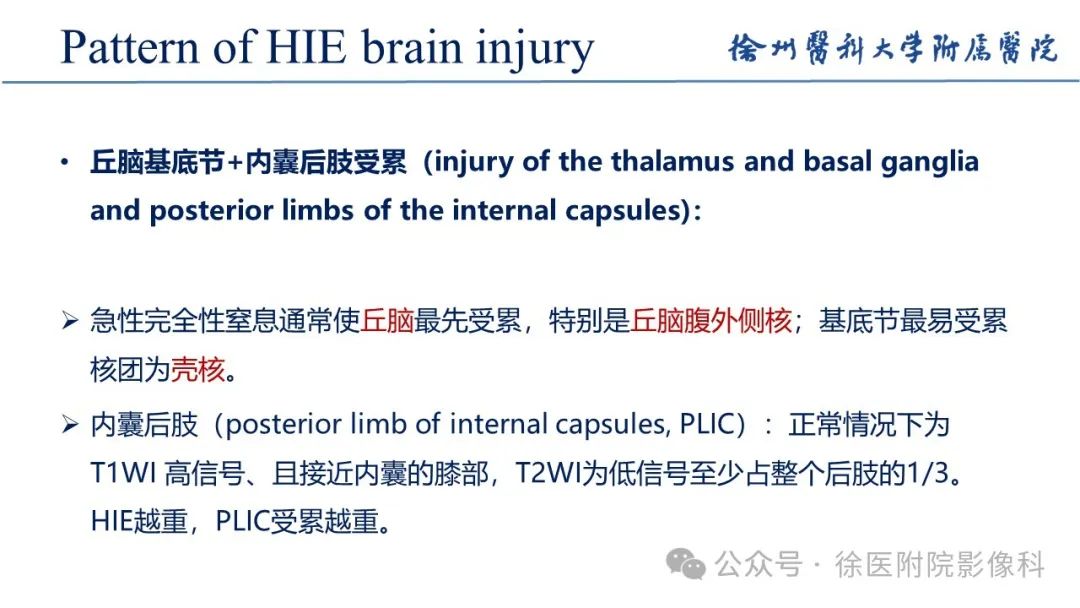 影像PPT - 【PPT】新生儿缺氧缺血性脑病-12