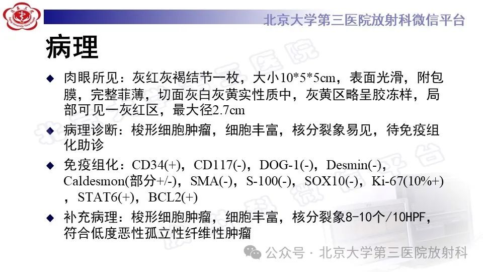 影像PPT - 【PPT】盆腔孤立性纤维性肿瘤-11