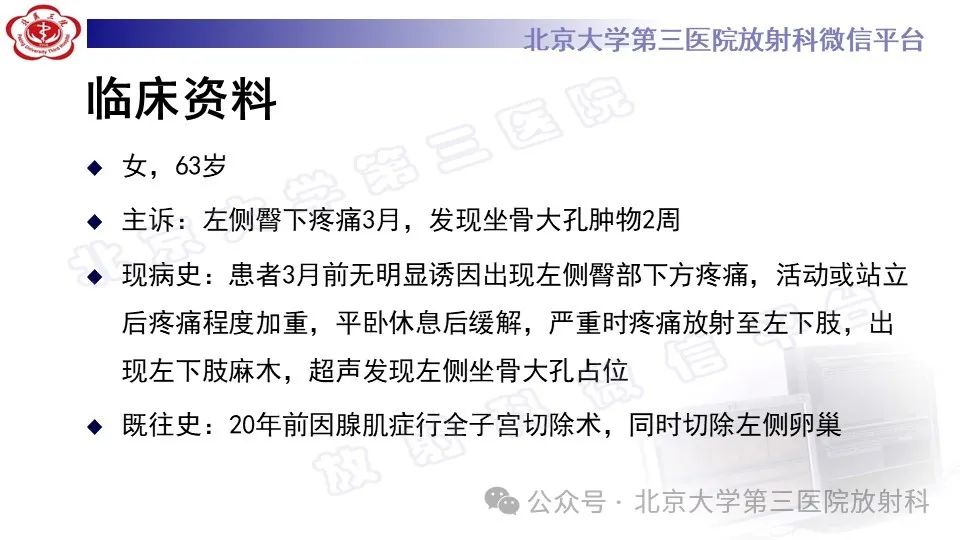 影像PPT - 【PPT】盆腔孤立性纤维性肿瘤-2
