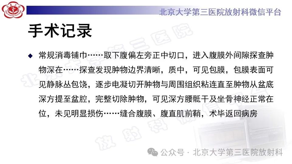 影像PPT - 【PPT】盆腔孤立性纤维性肿瘤-7