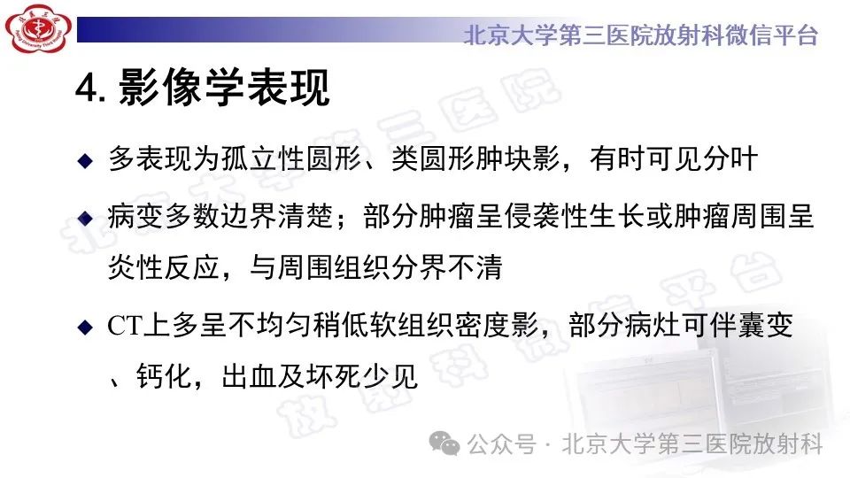 影像PPT - 【PPT】盆腔孤立性纤维性肿瘤-13