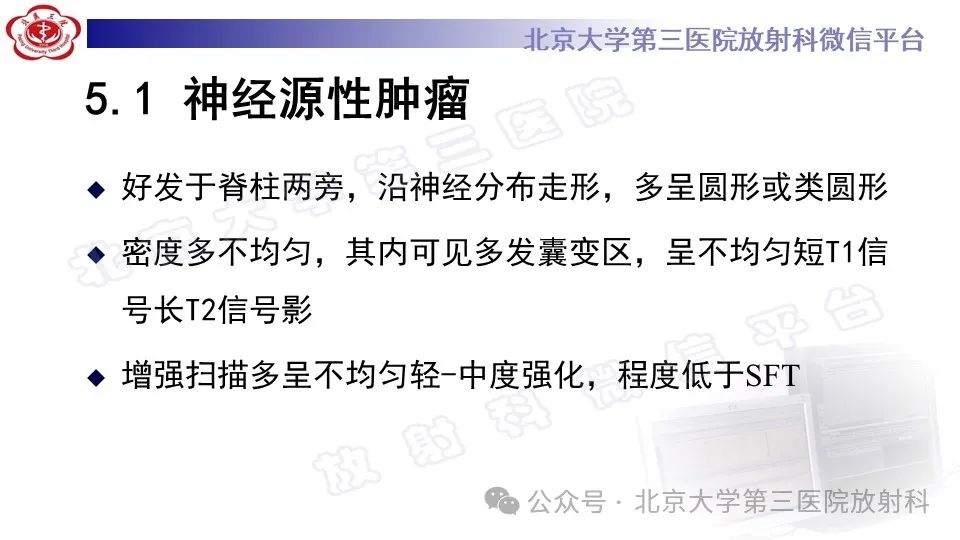 影像PPT - 【PPT】盆腔孤立性纤维性肿瘤-20