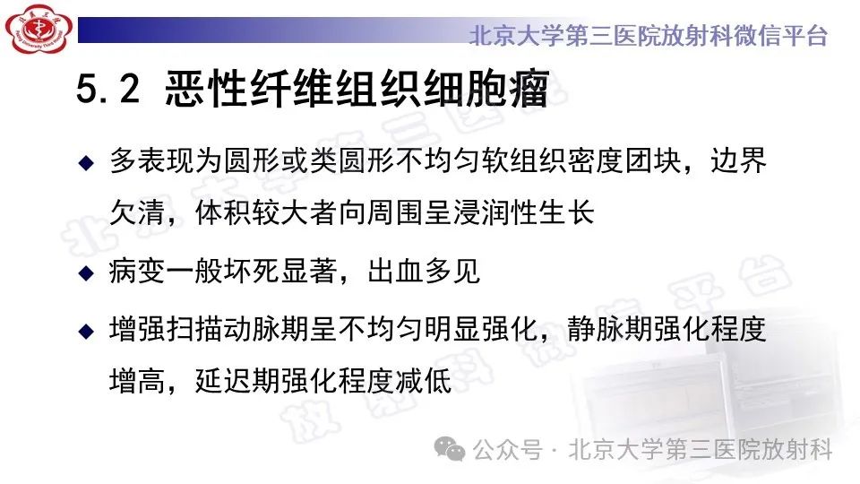 影像PPT - 【PPT】盆腔孤立性纤维性肿瘤-22