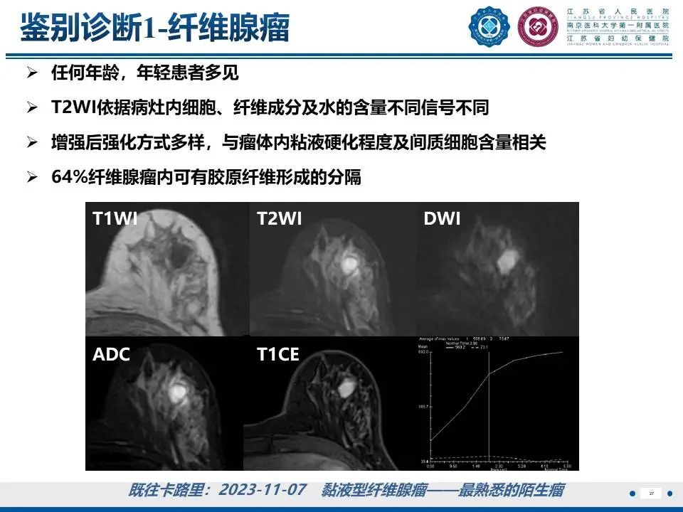 影像PPT - 【PPT】良性乳腺黏液囊肿样病变-28