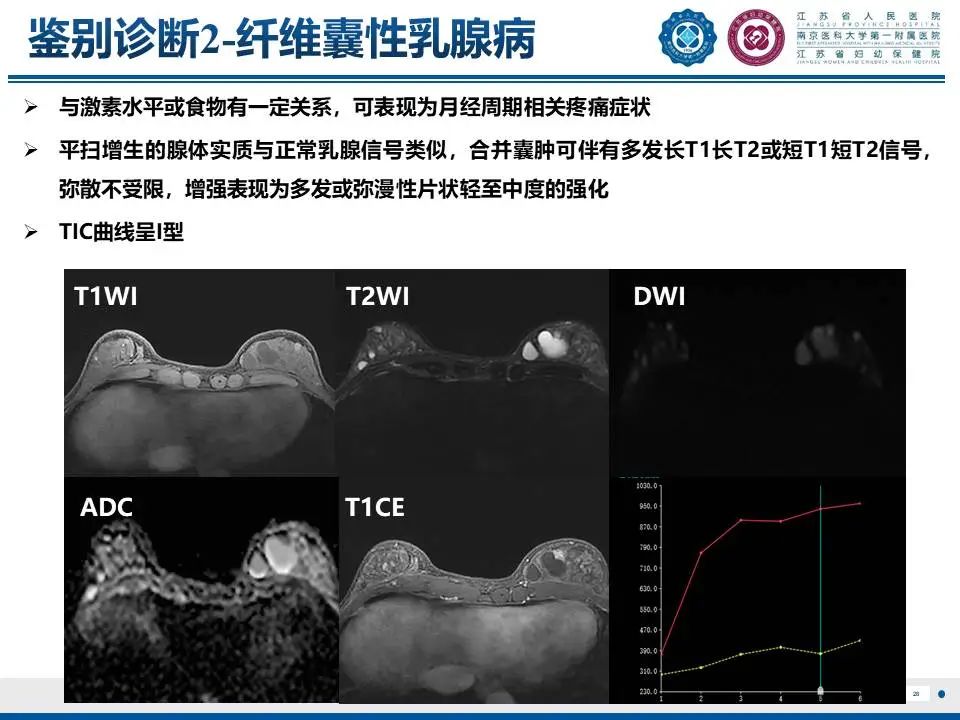 影像PPT - 【PPT】良性乳腺黏液囊肿样病变-29