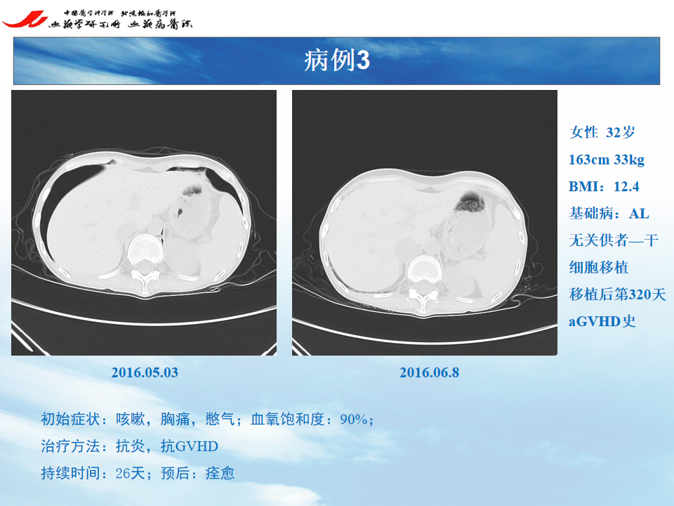 影像PPT - 【PPT】 空气渗漏综合症（ALS）-4