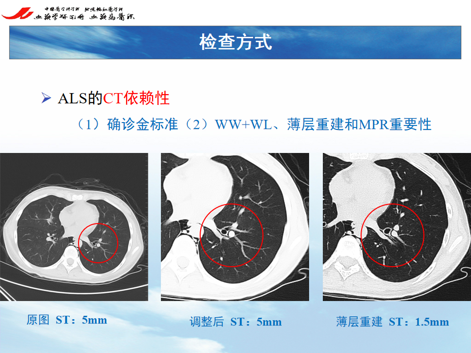 影像PPT - 【PPT】 空气渗漏综合症（ALS）-8