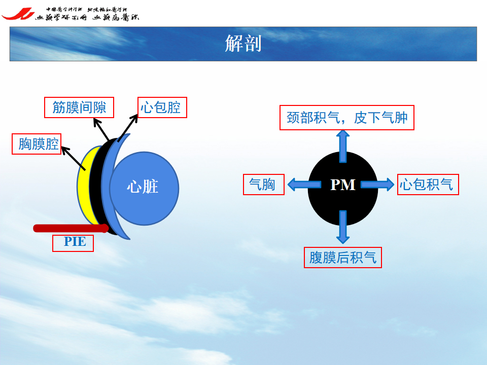 影像PPT - 【PPT】 空气渗漏综合症（ALS）-16