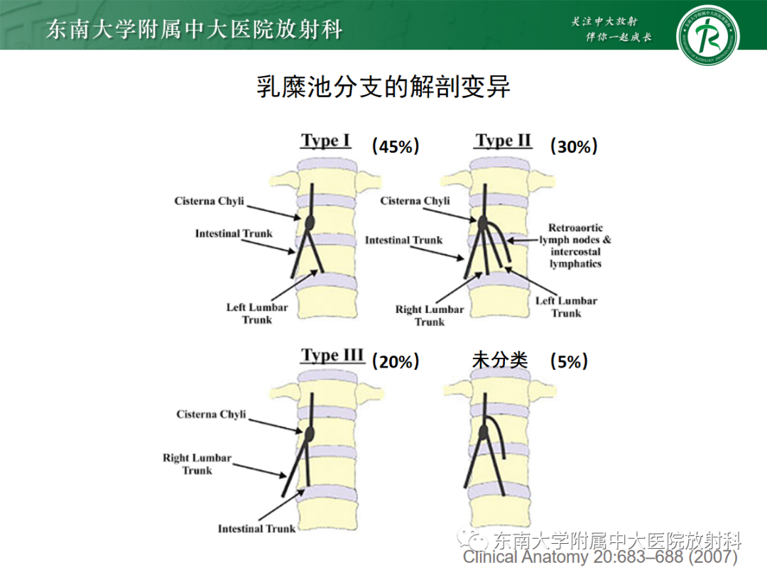 影像PPT - 【PPT】扩大乳糜池的影像表现及其鉴别诊断-8 影像PPT - 【PPT】扩大乳糜池的影像表现及其鉴别诊断-8