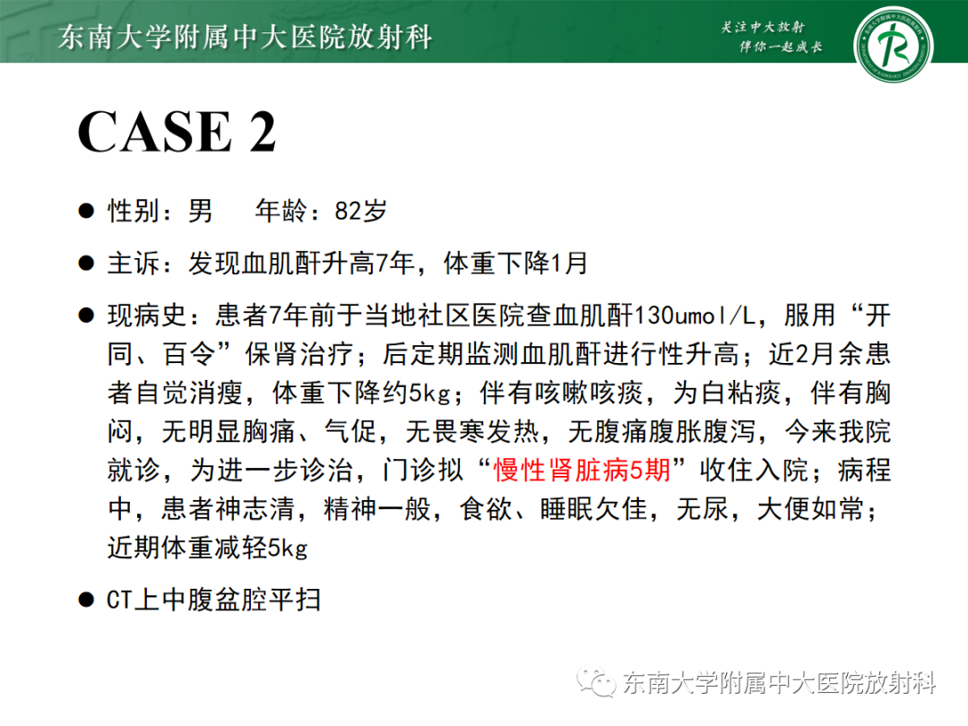 影像PPT - 【PPT】扩大乳糜池的影像表现及其鉴别诊断-19 影像PPT - 【PPT】扩大乳糜池的影像表现及其鉴别诊断-19