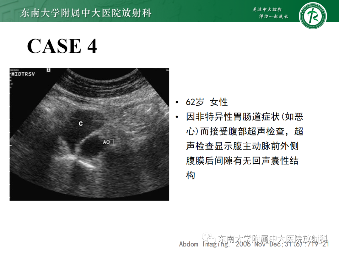 影像PPT - 【PPT】扩大乳糜池的影像表现及其鉴别诊断-23 影像PPT - 【PPT】扩大乳糜池的影像表现及其鉴别诊断-23