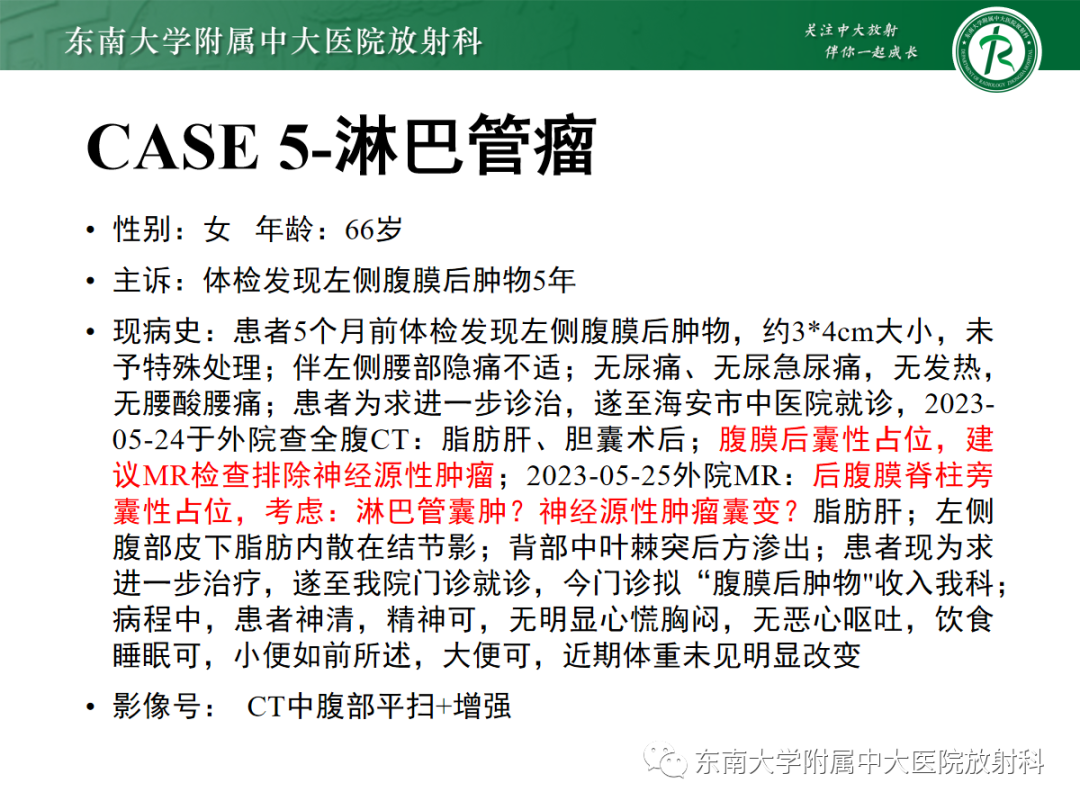 影像PPT - 【PPT】扩大乳糜池的影像表现及其鉴别诊断-26 影像PPT - 【PPT】扩大乳糜池的影像表现及其鉴别诊断-26