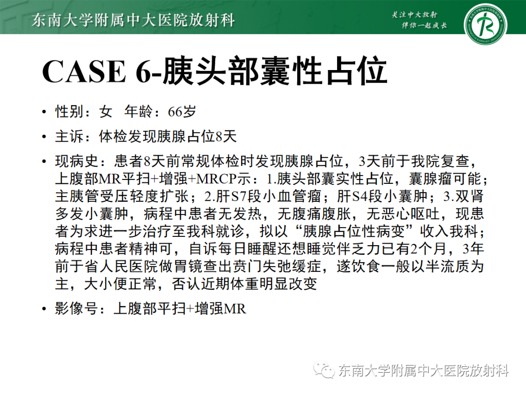 影像PPT - 【PPT】扩大乳糜池的影像表现及其鉴别诊断-29 影像PPT - 【PPT】扩大乳糜池的影像表现及其鉴别诊断-29