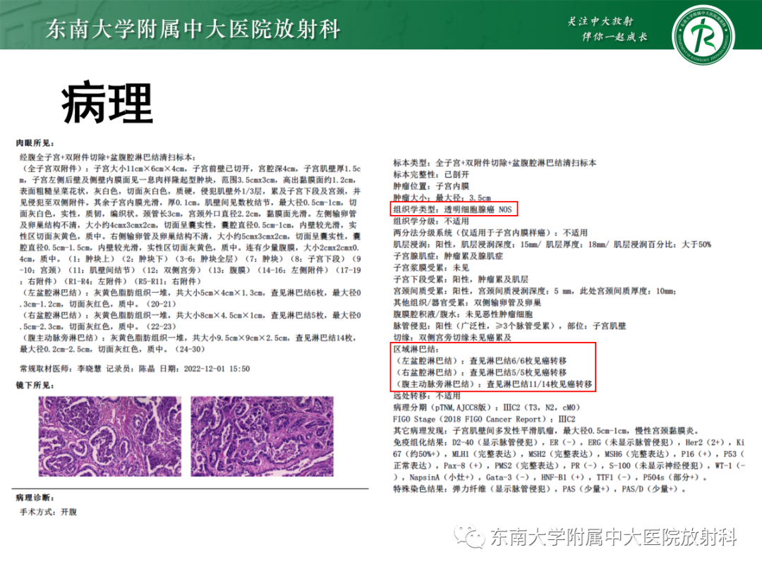影像PPT - 【PPT】扩大乳糜池的影像表现及其鉴别诊断-34 影像PPT - 【PPT】扩大乳糜池的影像表现及其鉴别诊断-34