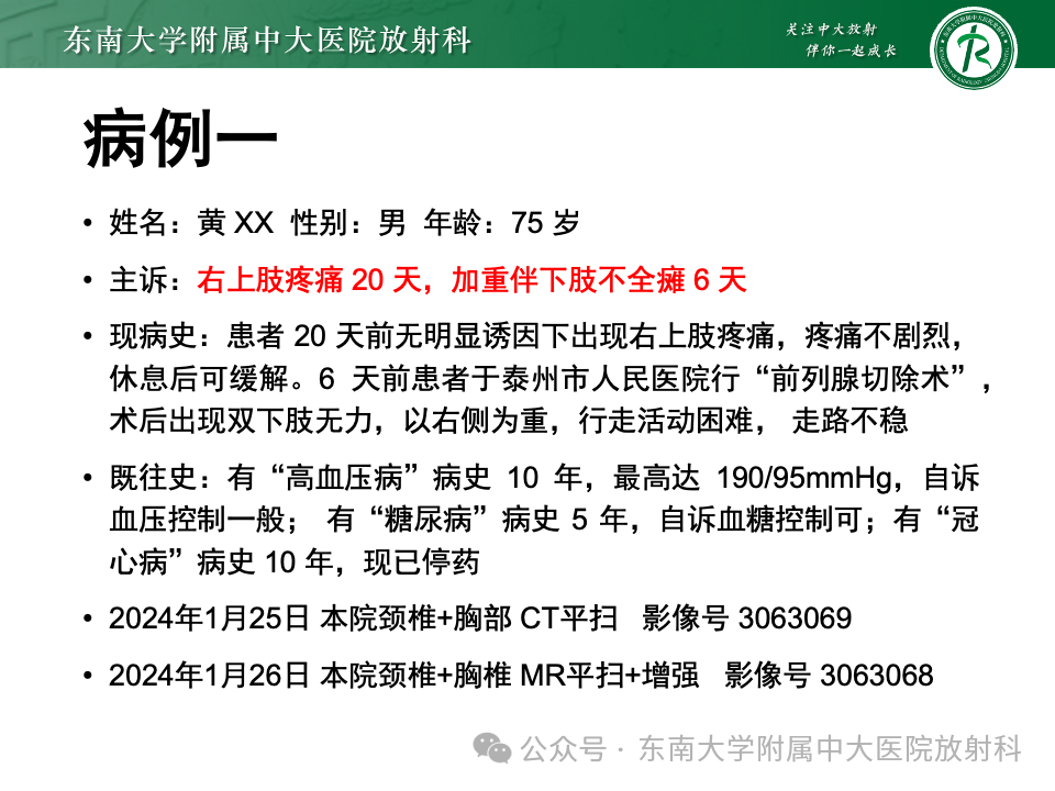 影像PPT - 【PPT】脊髓罕见占位性病变-5 影像PPT - 【PPT】脊髓罕见占位性病变-5