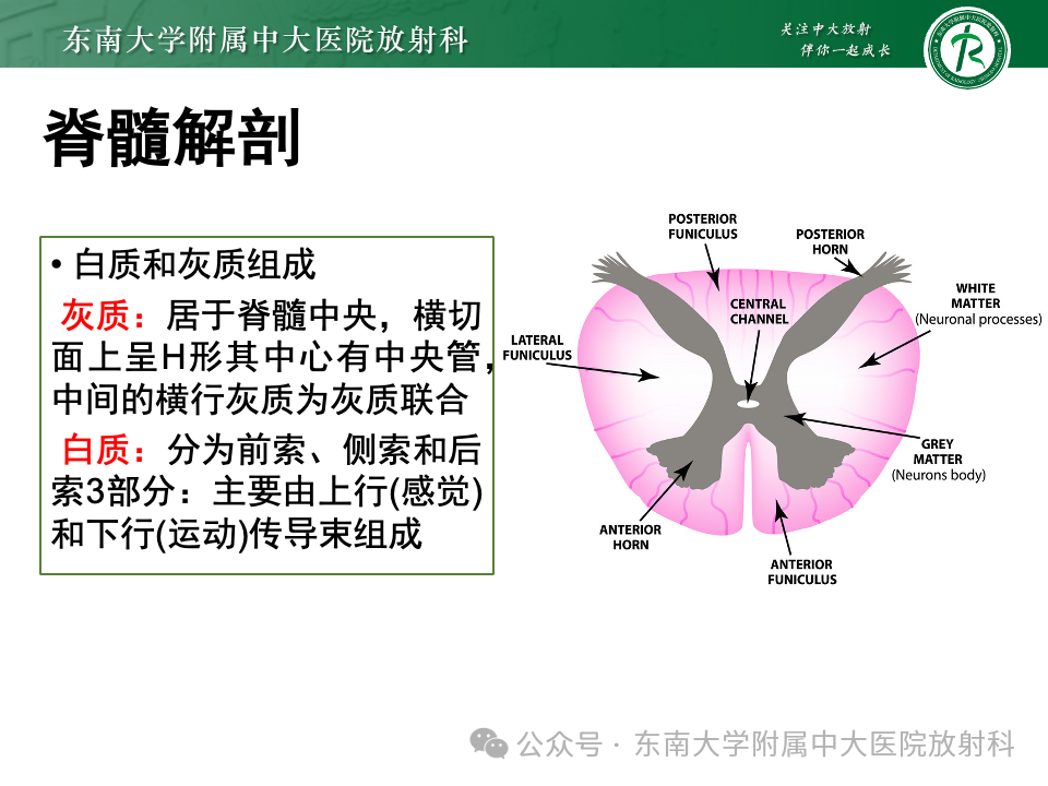 影像PPT - 【PPT】脊髓罕见占位性病变-14 影像PPT - 【PPT】脊髓罕见占位性病变-14