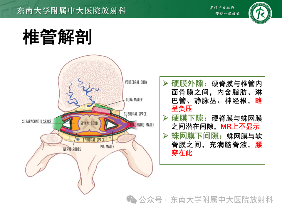 影像PPT - 【PPT】脊髓罕见占位性病变-13 影像PPT - 【PPT】脊髓罕见占位性病变-13