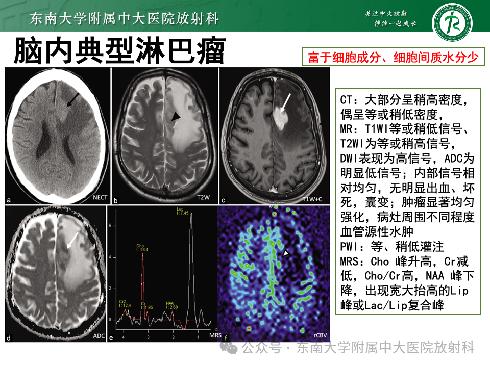影像PPT - 【PPT】脊髓罕见占位性病变-19 影像PPT - 【PPT】脊髓罕见占位性病变-19