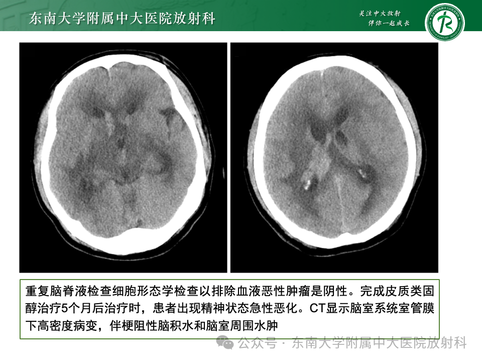 影像PPT - 【PPT】脊髓罕见占位性病变-26 影像PPT - 【PPT】脊髓罕见占位性病变-26