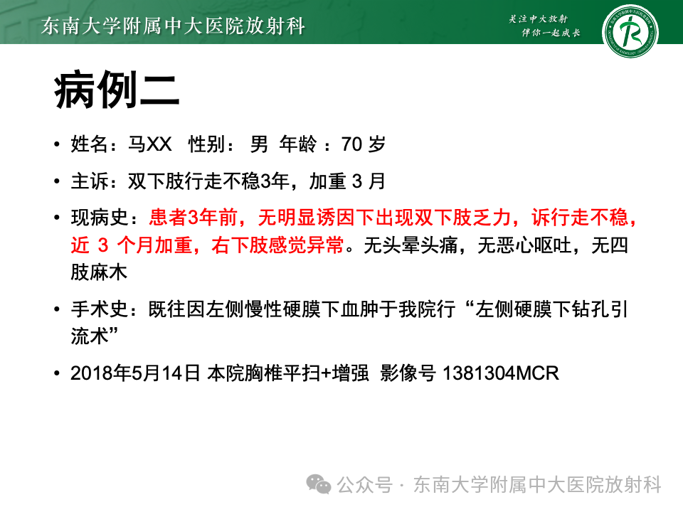 影像PPT - 【PPT】脊髓罕见占位性病变-30 影像PPT - 【PPT】脊髓罕见占位性病变-30