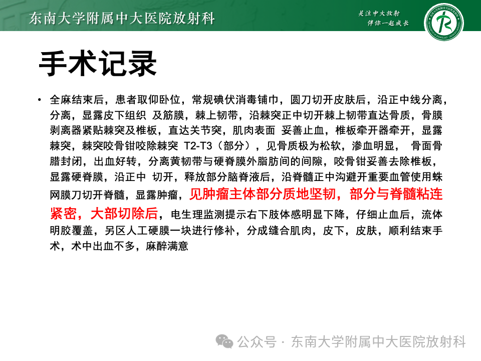 影像PPT - 【PPT】脊髓罕见占位性病变-33 影像PPT - 【PPT】脊髓罕见占位性病变-33
