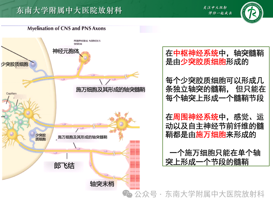 影像PPT - 【PPT】脊髓罕见占位性病变-36 影像PPT - 【PPT】脊髓罕见占位性病变-36