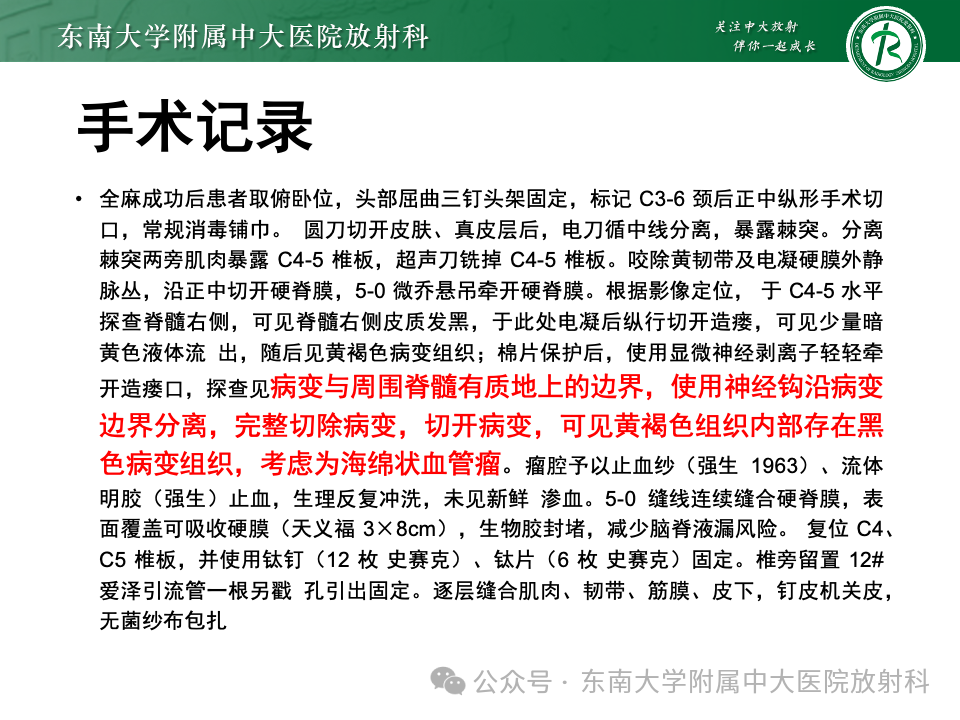 影像PPT - 【PPT】脊髓罕见占位性病变-46 影像PPT - 【PPT】脊髓罕见占位性病变-46