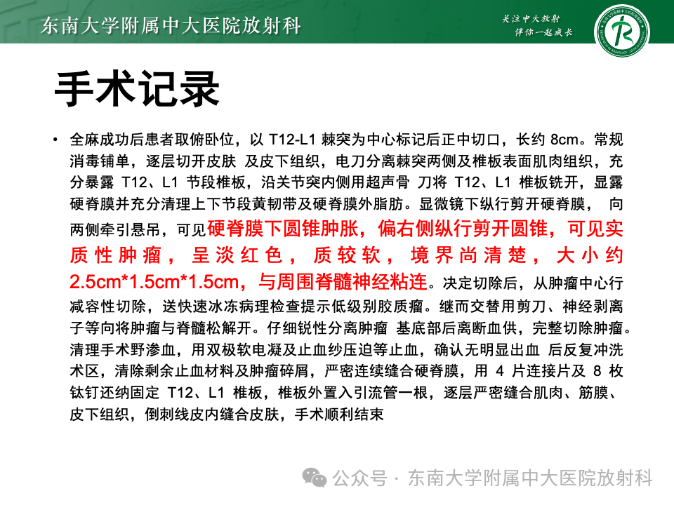 影像PPT - 【PPT】脊髓罕见占位性病变-55 影像PPT - 【PPT】脊髓罕见占位性病变-55