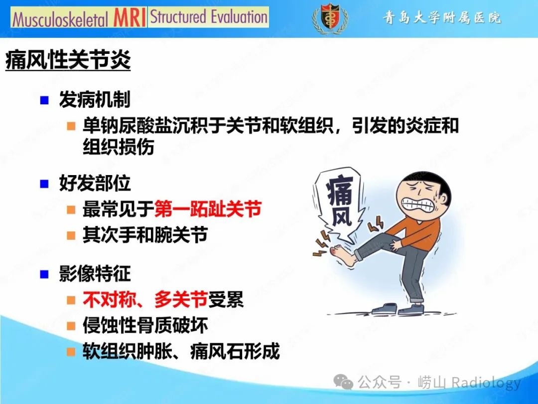 影像PPT - 【PPT】感染和炎症/关节炎-6