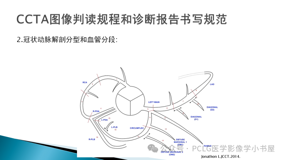 影像PPT - 【PPT】冠状动脉CTA检查方法及影像诊断-16